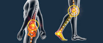 Why Your Back Pain Could Start in Your Feet