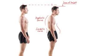 How Poor Posture Affects Your Digestive Health