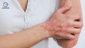 The Connection Between Gut Bacteria and Skin Problems