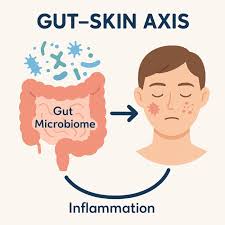 The Connection Between Gut Bacteria and Skin Problems